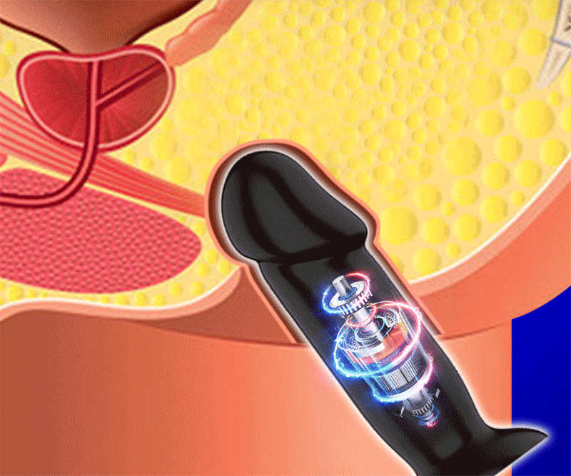 Silicone Prostate Massager Vibrating Gspot Stimulator Anal Dildo With Large Beads Butt Plug Couples Sexual Toy 5 Sizes - 3