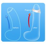 Cock Ring C-type Foreskin Correction Penis Delay Ejaculation Resistance Trainer Adult Sex Toys For Men Glans - 4