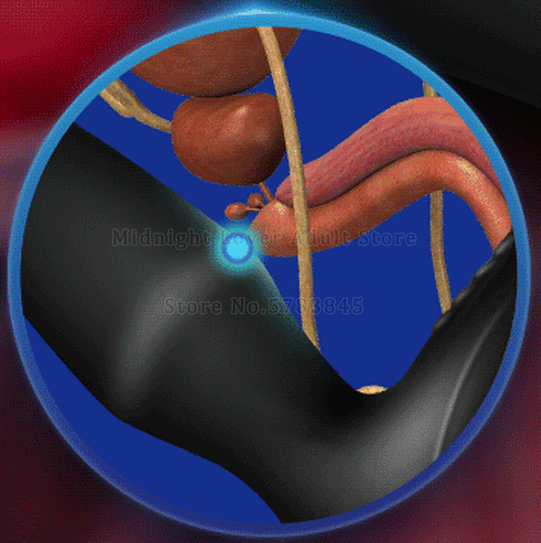 Remote Control Prostate Vibrator Telescopic Anal Massager Vibrating Butt Plug Male Masturbation Gay Sex Toy - 3