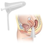 Anal Speculum Plug Adult Clean Examination Enema Sex Toys Enemator Products For Men Couple - 3