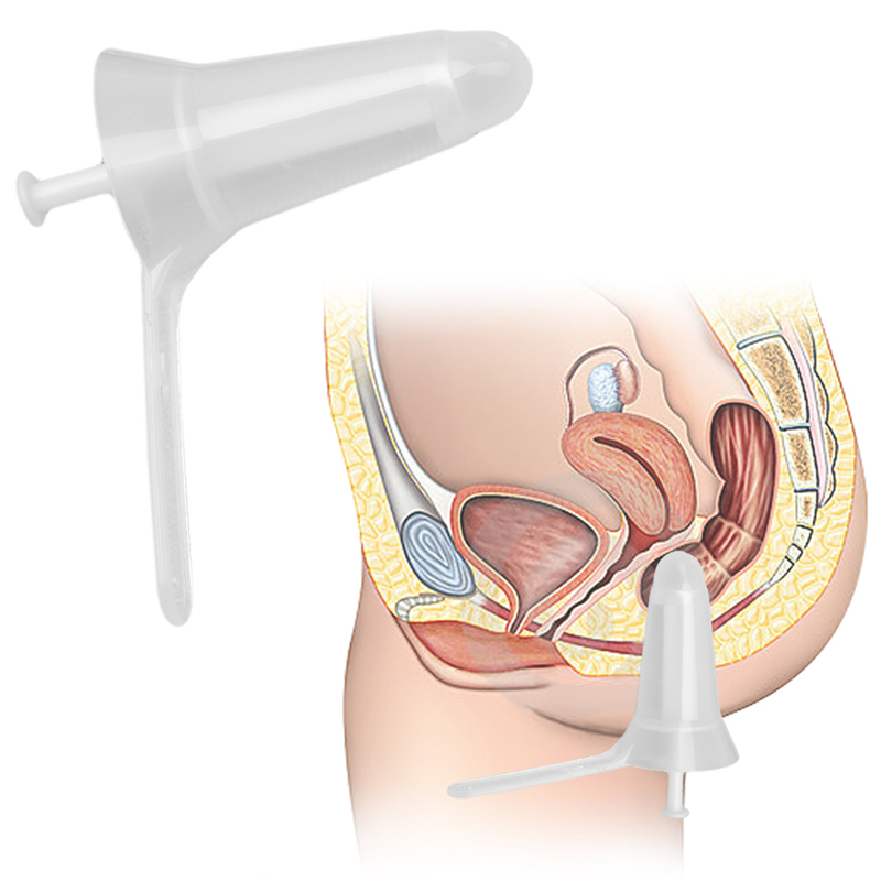 Anal Exploration Speculum Plug Couples Intimate Adult Toy For Hygienic Enema Cleaning - 2