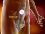 Penis Enlarger Male Sexual Massager Electric Shock Medical Sex Toy For Man Pro Expander - 4