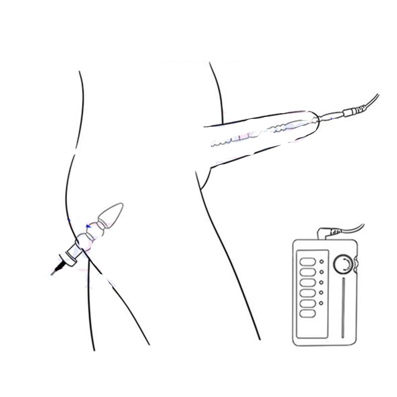Electric Shock Urethral Plug Anal Toy Medical Themed Adult Game Sexual Enhancement Product For Men I9176 - 3